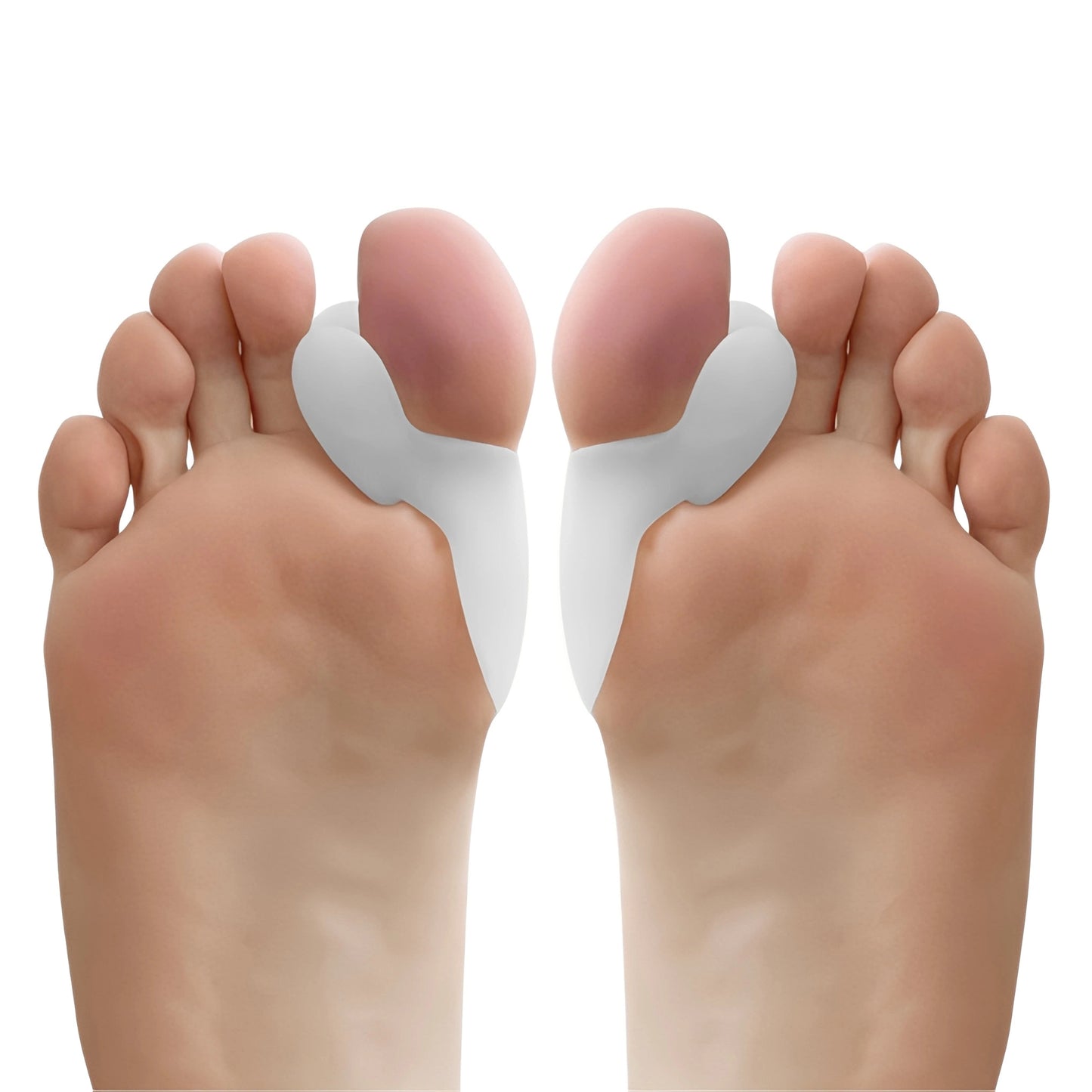 Illustration som visar hur tåseparatorn skapar avstånd mellan tårna