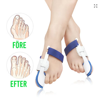 Natskinne til hallux valgus