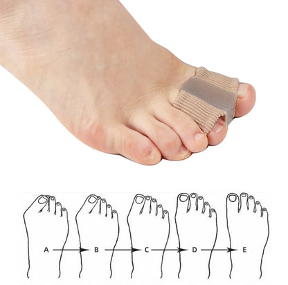 Dubbel tåseparator för hallux valgus placerad mellan stortå och intilliggande tå.