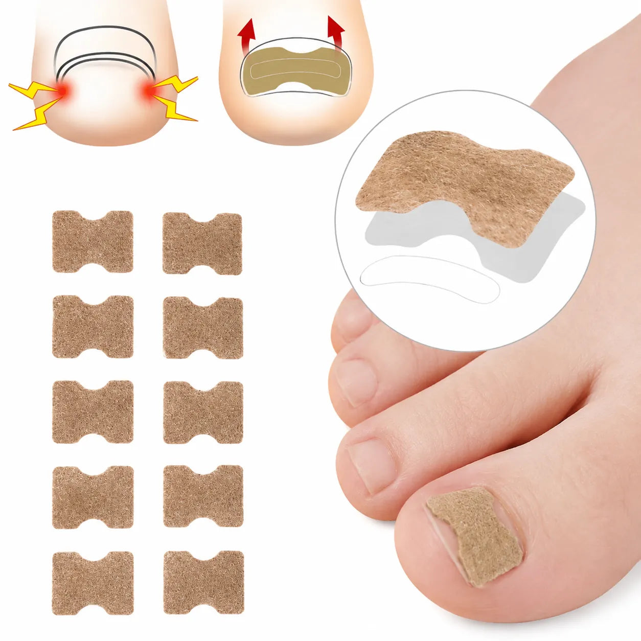 Nageltejp applicerad på stortån med illustration av tejpens placering runt nagelkanten.